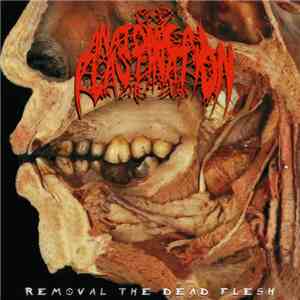 Anatomical Plastination - Removal The Dead Flesh download free Anatomical Plastination - Removal The Dead Flesh download mp3 flac