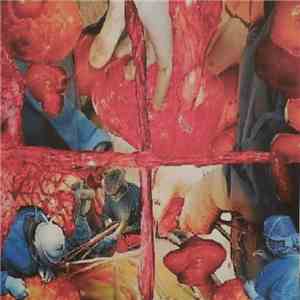 Urinary Tract Infection From Severe Pus Clots - A Bioangliocystadenomyostomic Sado-Surgery download mp3 flac